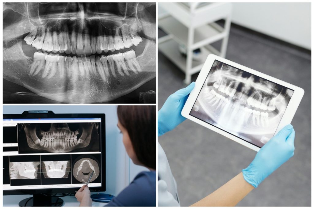 Prefeitura recebe novo RX panorâmico para a Odontologia Municipal de Naviraí
